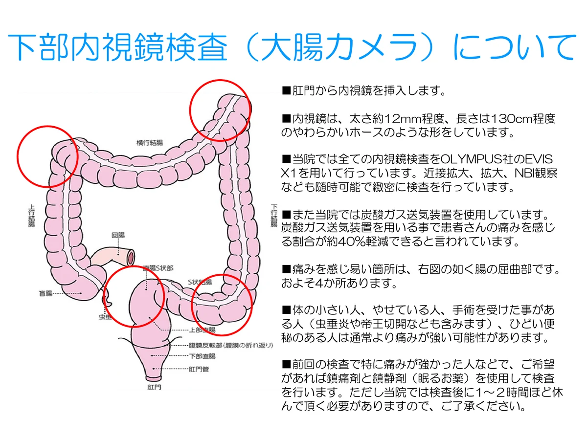 大腸カメラの概要と腸の曲がり角の説明図